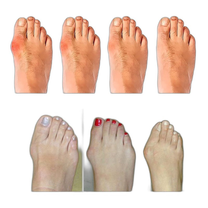 Carrie – Sandali da donna con punta ampia per il comfort tutto il giorno